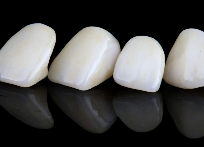 e-max｜おひさま歯科