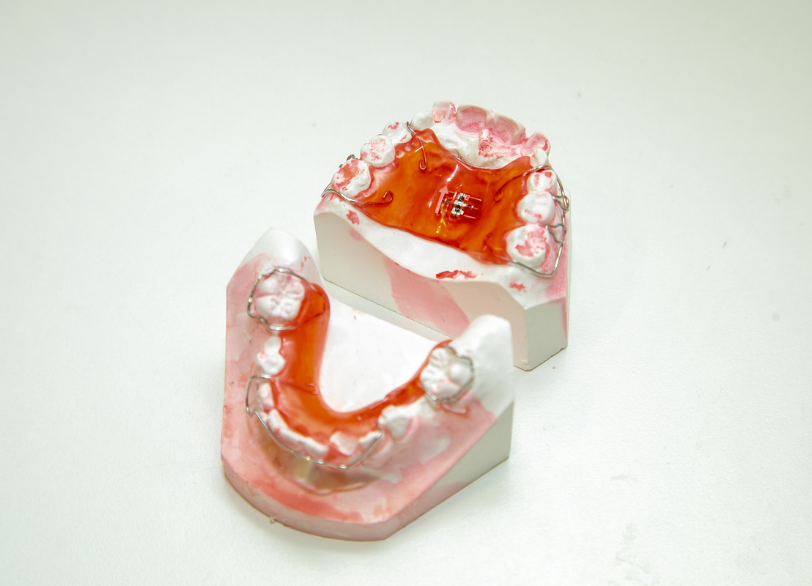 拡大装置（固定式／可撤式）｜おひさま歯科