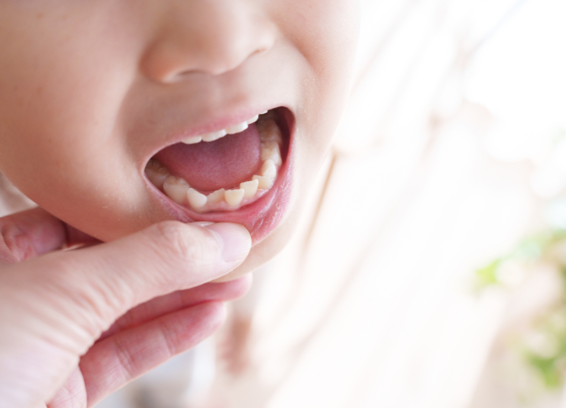 適切な治療開始時期｜おひさま歯科