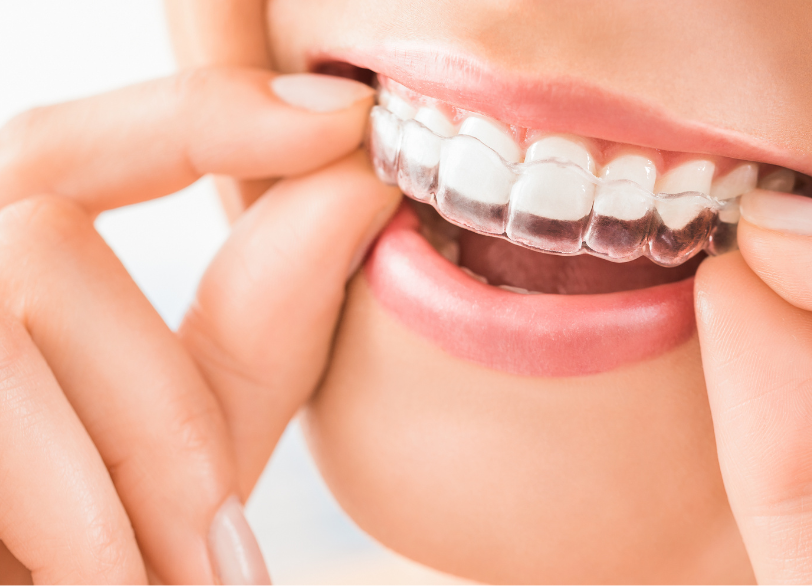 自己管理の重要性｜おひさま歯科