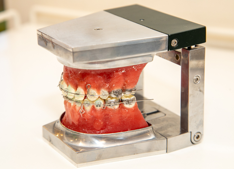 ワイヤー矯正｜おひさま歯科