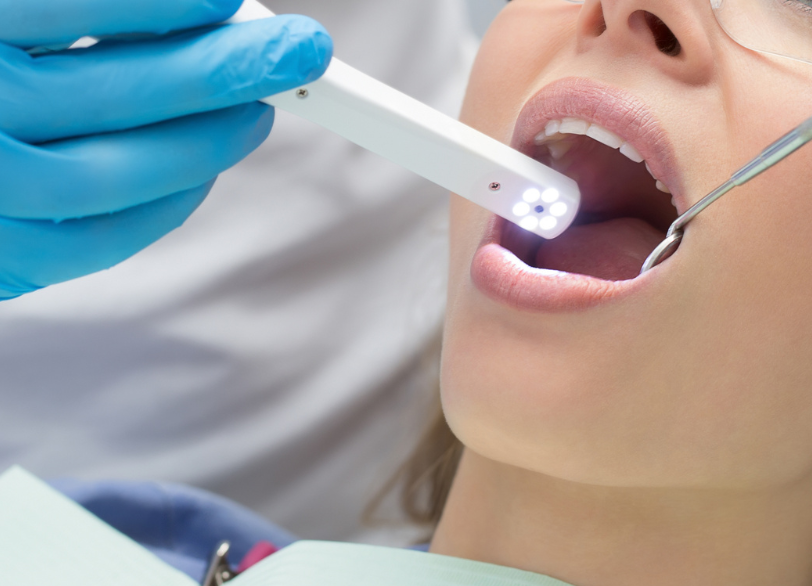 口腔内カメラ｜おひさま歯科