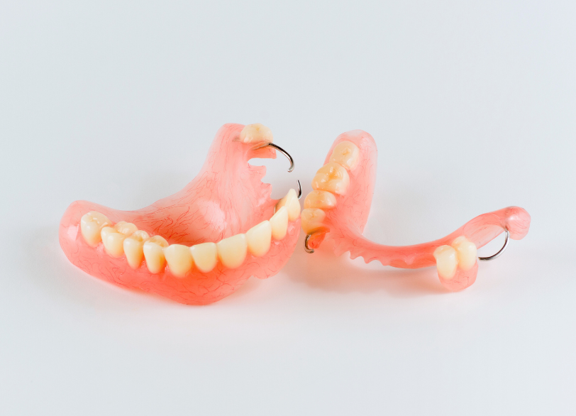 レジン床義歯｜おひさま歯科