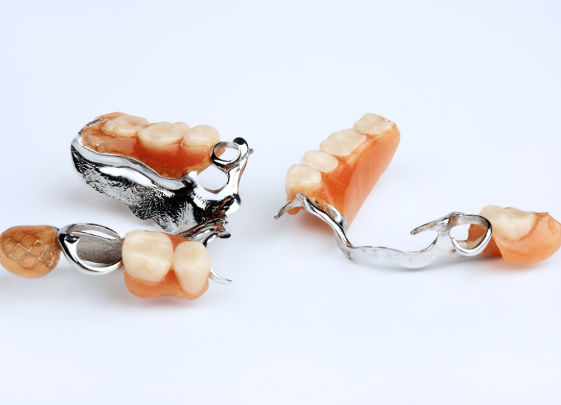 金属床義歯｜おひさま歯科