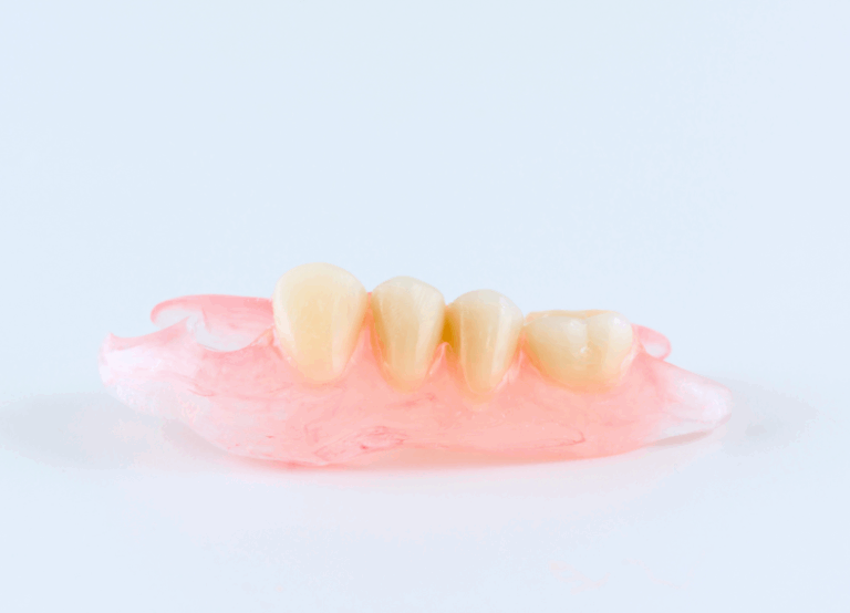 ノンクラスプデンチャー｜おひさま歯科