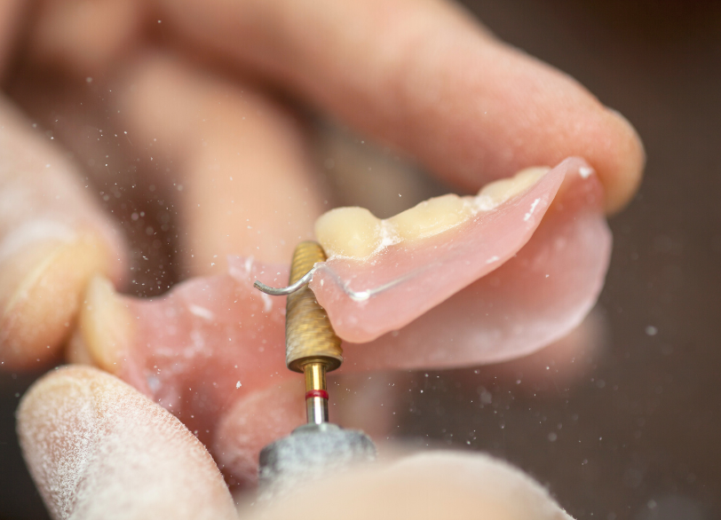 歯科医師と歯科技工士の「二人三脚｜おひさま歯科