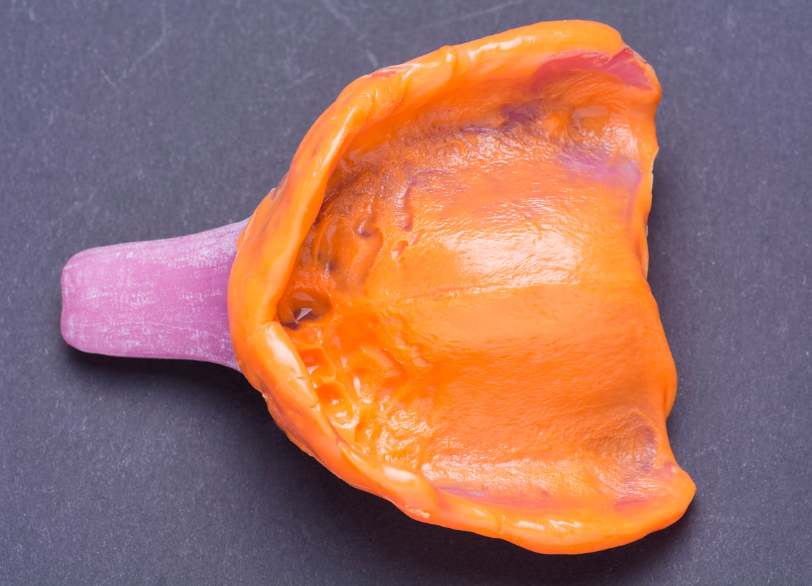 個人トレー｜おひさま歯科