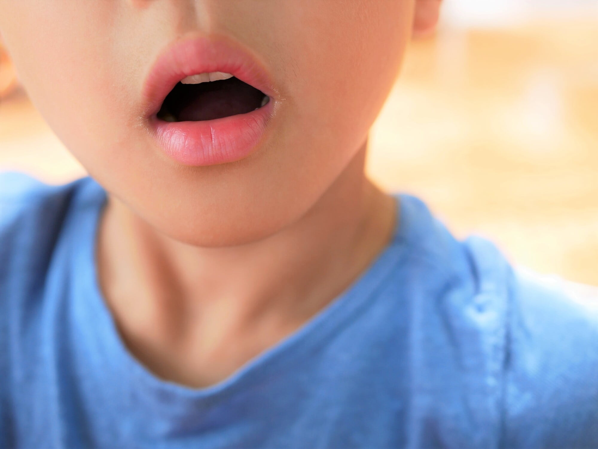 受け口の原因になる口呼吸をする子ども