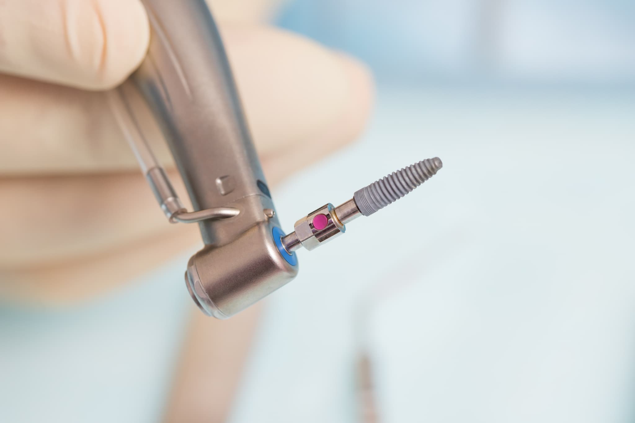 インプラント治療の様子