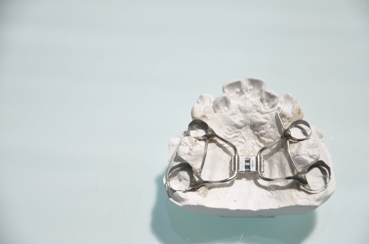 急速拡大装置のイメージ